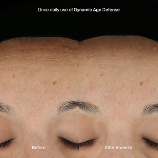 Dynamic Age Defense